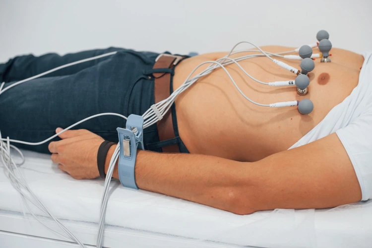 ECG (Electrocardiogram)